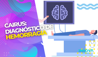 Cairus, una deidad para diagnosticar hemorragias cerebrales