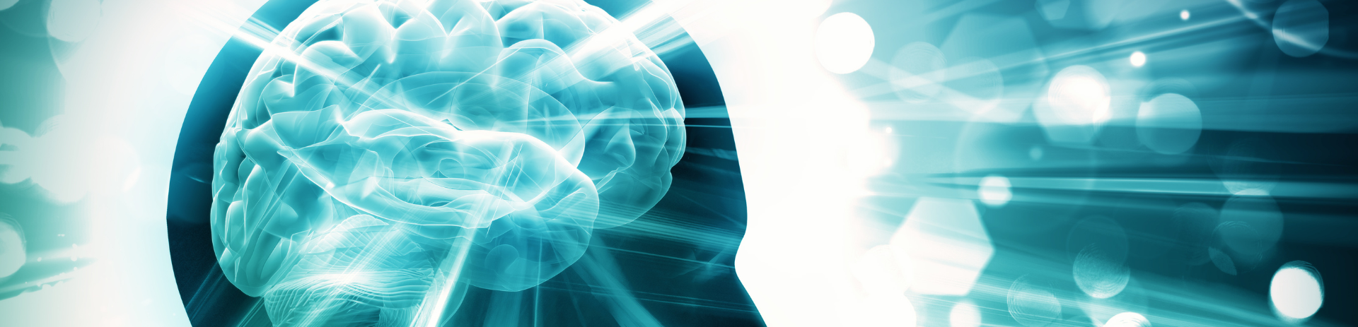 Cairus, una deidad para diagnosticar hemorragias cerebrales